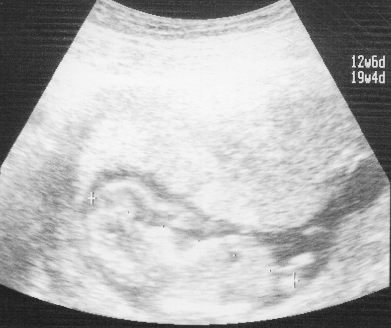 妊娠12週の壁 とは 流産の確率と関係があるの こそだてハック