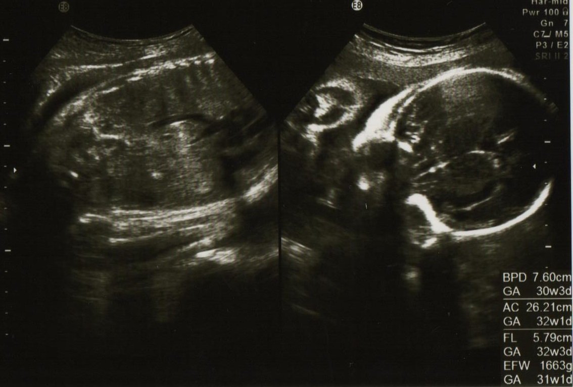 妊娠30週の胎児の体重やお腹の大きさは こそだてハック
