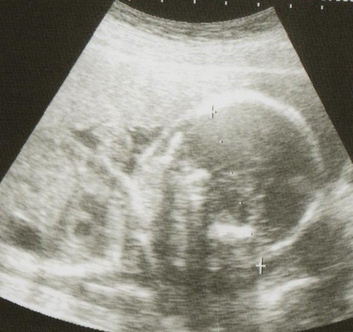 妊娠週 お腹の大きさや体重の増加量は 胎児の様子は こそだてハック 妊娠週 お腹の大きさや体重の増加量は 胎児の様子は こそだてハック