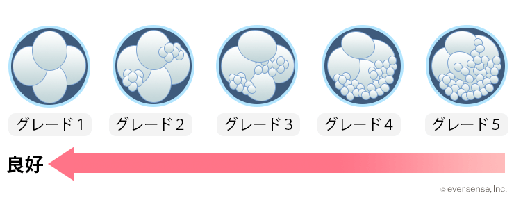 凍結胚移植のスケジュールが知りたい 移植日はいつ 着床時期は こそだてハック